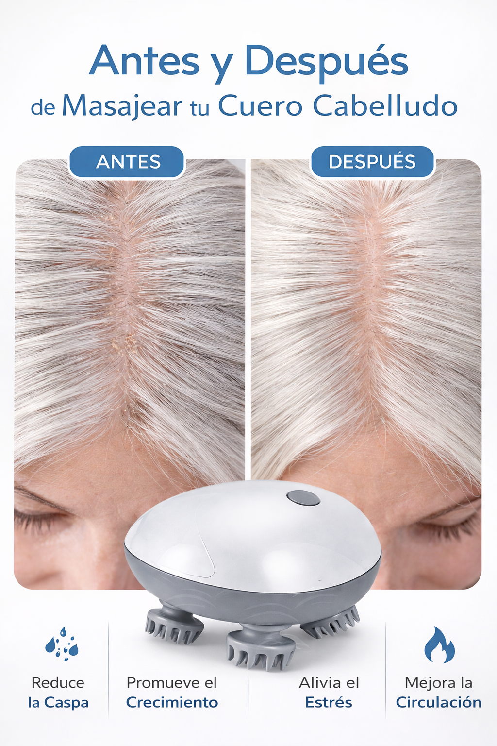 MAKZOU VibraScalp™ – Masajeador Eléctrico Capilar 2 en 1